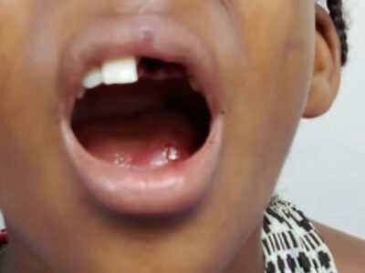 Impacto en San Cristóbal: Un padre agredió a su hija causando la pérdida de dos dientes