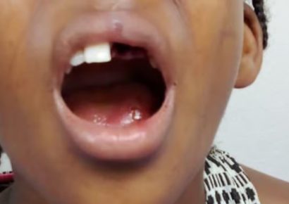 Impacto en San Cristóbal: Un padre agredió a su hija causando la pérdida de dos dientes