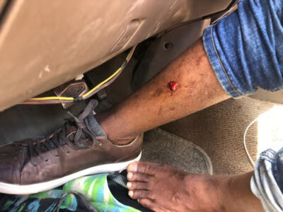 Asalto en Santiago: Comerciante haitiano herido por banda 400 Mawozo