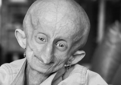 Fallece Beandri Booysen, la joven influencer sudafricana que inspiró al mundo con su lucha contra la progeria