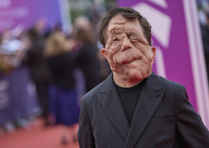 Adam Pearson responde con contundencia a comentario despectivo en redes sociales antes de los BAFTA 2025