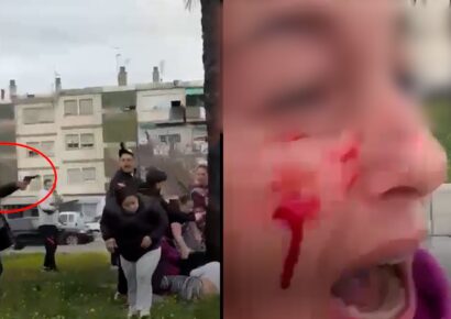 Enfrentamiento en Granada deja un herido de bala