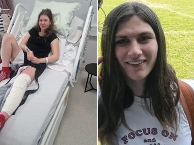 jugadora trans de rugby destroza la rodilla de su rival y arruina su carrera deportiva