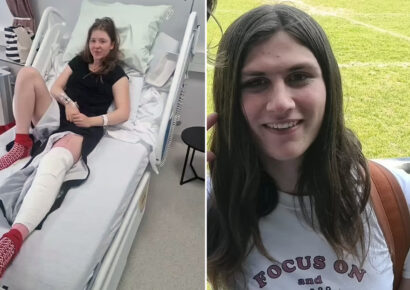 jugadora trans de rugby destroza la rodilla de su rival y arruina su carrera deportiva