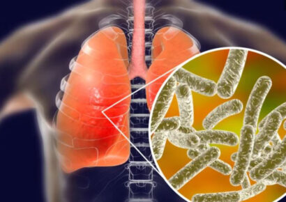 Brote de enfermedad del legionario en Harlem deja un fallecido y 22 afectados