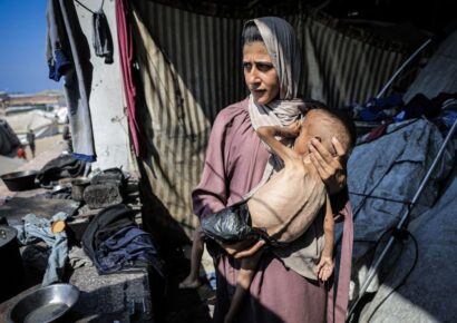 Mueren seis personas por desnutrición en Gaza; suman 133 las víctimas desde octubre