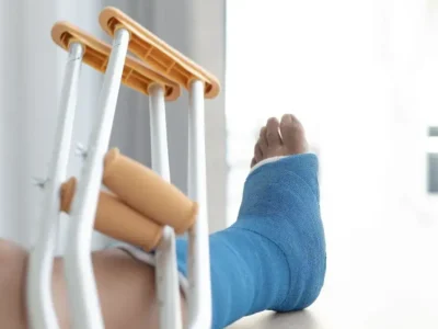 Científicos chinos crean pegamento óseo que repara fracturas en tres minutos