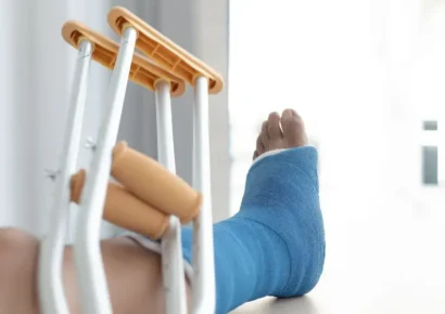 Científicos chinos crean pegamento óseo que repara fracturas en tres minutos