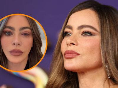 Sofía Vergara se ausenta de los Emmy 2025 tras sufrir una fuerte reacción alérgica