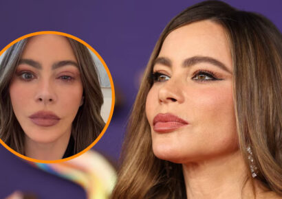 Sofía Vergara se ausenta de los Emmy 2025 tras sufrir una fuerte reacción alérgica