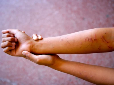 Unicef alerta que 76 % de adolescentes dominicanas ha sufrido algún tipo de violencia