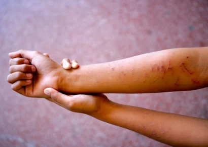 Unicef alerta que 76 % de adolescentes dominicanas ha sufrido algún tipo de violencia