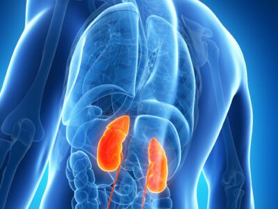 La enfermedad renal crónica: una amenaza silenciosa que puede prevenirse