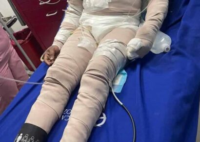 Hombre sufre graves quemaduras tras ataque con gasolina en La Altagracia