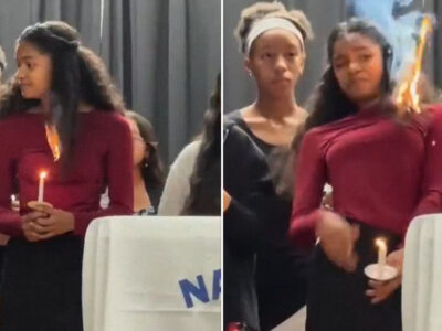 ¡Qué actitud! Joven asombra por su reacción luego de que su cabello se incendiara