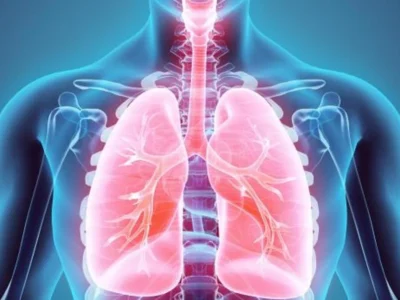 Neumólogos alertan sobre alza de infecciones respiratorias y llaman a vacunarse contra la influenza