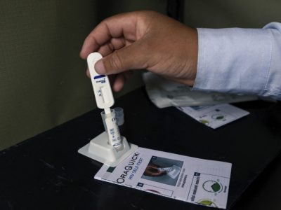Costa Rica autoriza autopruebas de VIH para impulsar la detección temprana