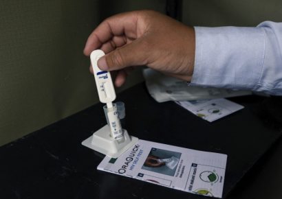 Costa Rica autoriza autopruebas de VIH para impulsar la detección temprana