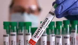 Panamá registra su primera víctima mortal por hantavirus