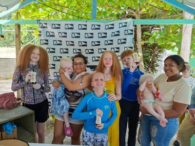 ALSOA celebra su quinto encuentro anual de confraternización en ocasión del Día Internacional de Sensibilización sobre el Albinismo