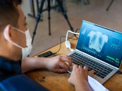 Estudio revela apertura de pacientes con tuberculosis al uso de tecnologías digitales