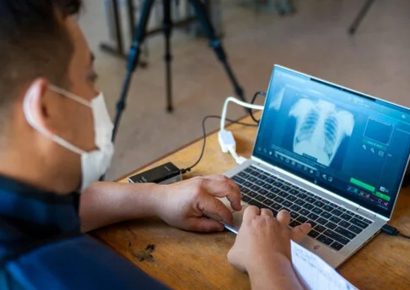 Estudio revela apertura de pacientes con tuberculosis al uso de tecnologías digitales