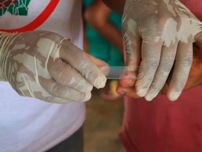 Brasil registra la cifra más baja de casos de malaria en casi 50 años