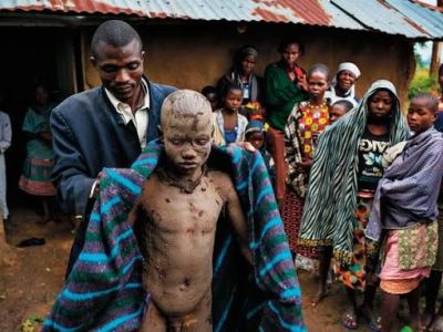 Al menos 43 adolescentes mueren en Sudáfrica durante polémicos rituales de circuncisión tradicional