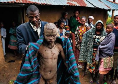 Al menos 43 adolescentes mueren en Sudáfrica durante polémicos rituales de circuncisión tradicional