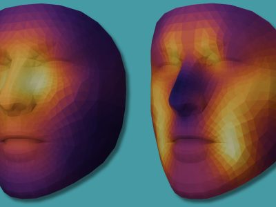 IA predice edad biológica y supervivencia en pacientes con cáncer a partir del rostro